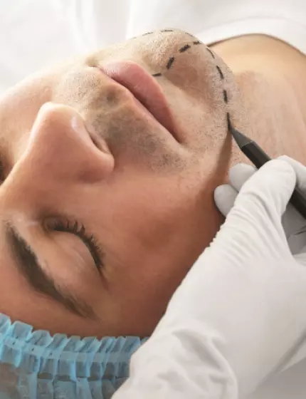 Facial plastic surgery