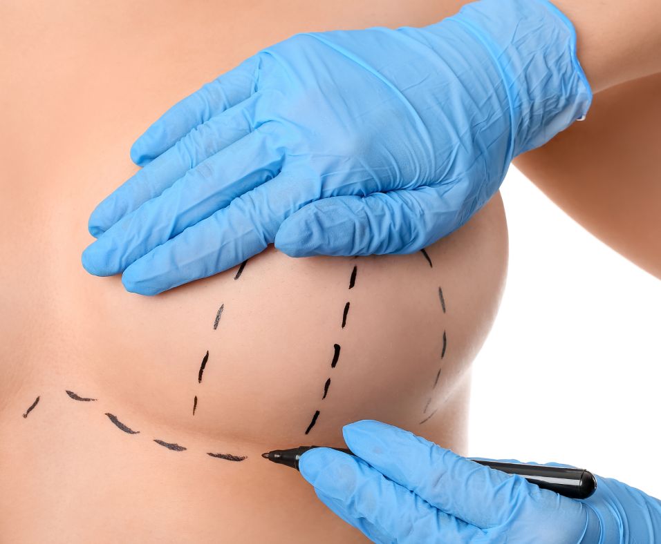 Пластическая хирургия тела