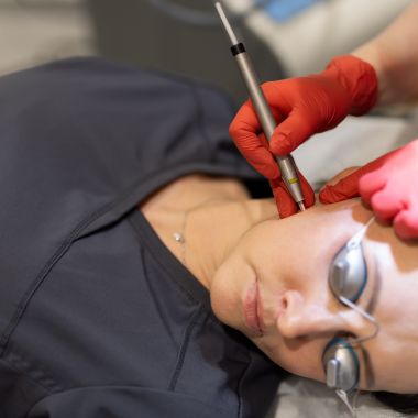 Ādas paplašināto asinsvadu likvidācija ar Excel V+  lāzeriekārtu  (COOL View)