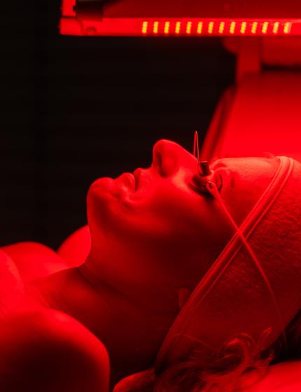 DermaPen procedūra ar sarkanās gaismas terapiju