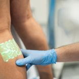 Pietūkušas kājas – kad tas var liecināt par vēnu slimību?