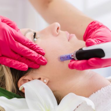 Mikroadatu mezoterapija ar DermaPen sejai