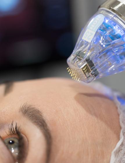 Skin lifting and rejuvenation