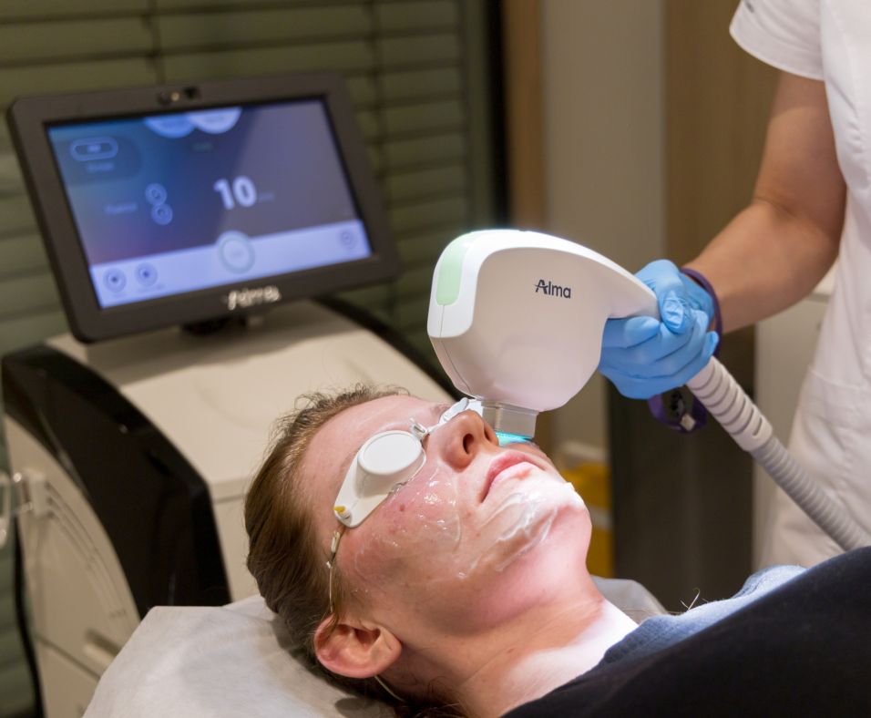 Paplašinātu asinsvadu korekcija