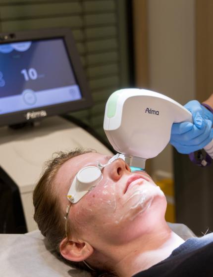 Removal of dilated blood vessels