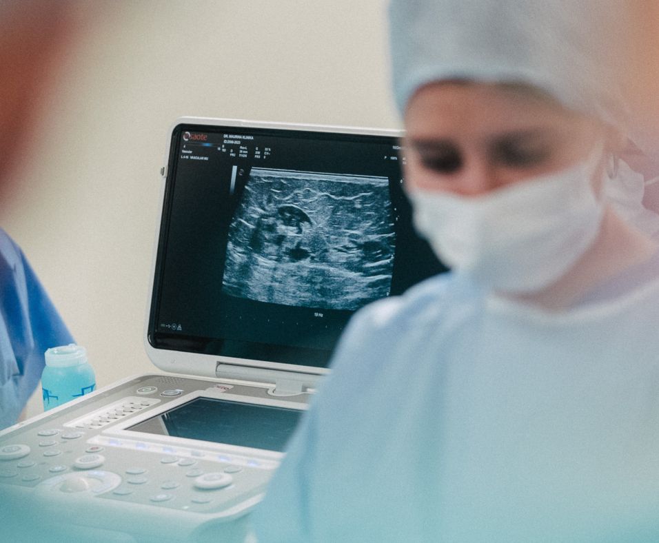 Vēnu lāzeroperācija