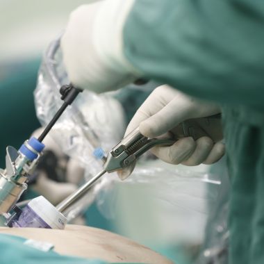 Laparoscopic surgery