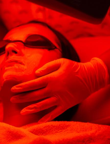 Chemical Peel with Red Light Therapy