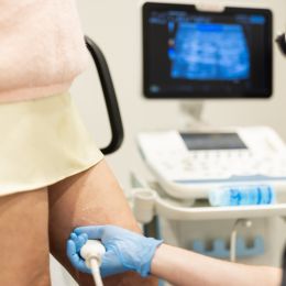 Leg vein diagnostics from 45 €