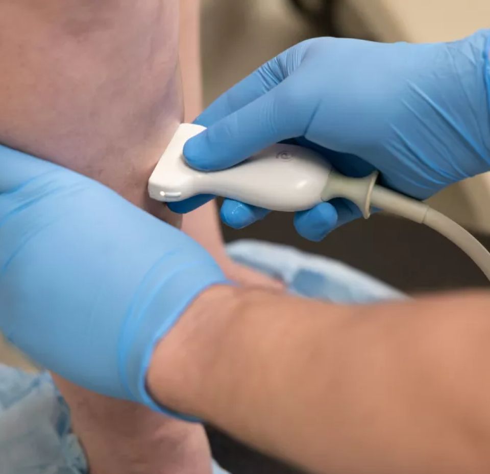 Ārstu ķirurgu FLEBOLOGU