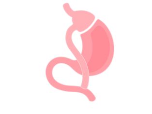 Gastric Bypass